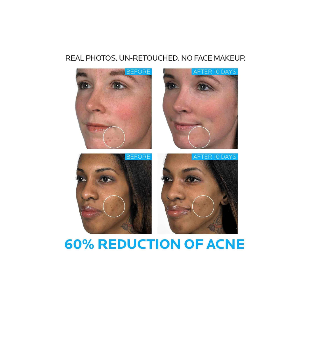 Tratamiento Anti Acné Effaclar Duo